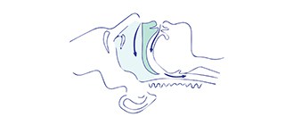 Tongue-based snoring
